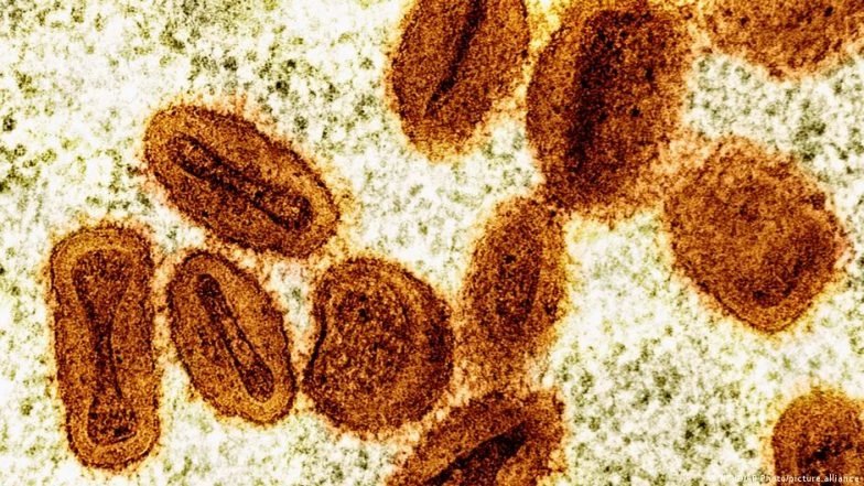 Strain baru virus Mpox: apa yang perlu Anda ketahui