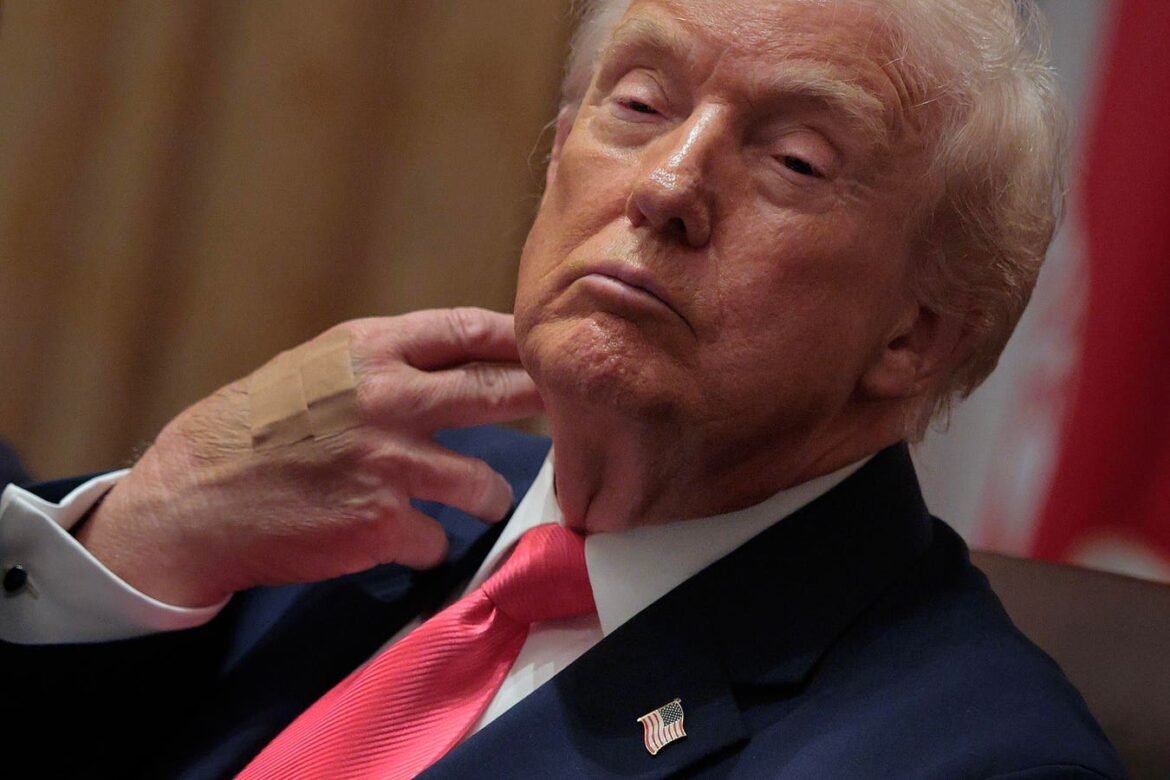 Trump tampil dengan tangan diperban untuk hari kedua berturut-turut